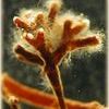 Mycorrhizae Fungi - A brief overview